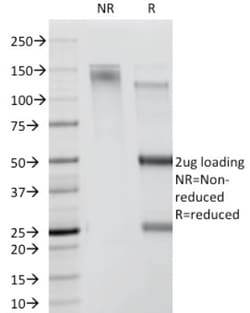 BA Antigen (Leu21) Antibody (DF1588), Novus Biologicals 20&mu;g; Unlabeled:Antibodies,